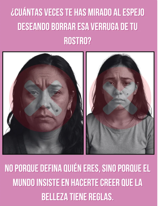 LUMINIIX - ELIMINADOR DE VERRUGAS