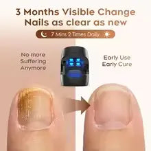 Laser  Clean Uñas